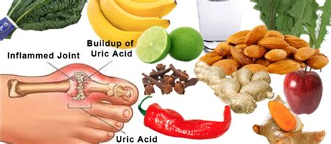 10 Easy To Incorporate Lifestyle And Diet Changes To Control Uric Acid