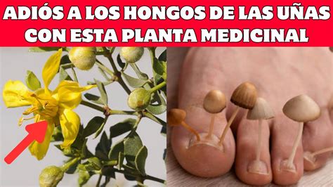 La Planta Milagrosa Soluci N Definitiva Para Pies Apestosos Y