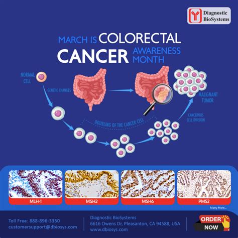 Colorectal Cancer Awareness Month Diagnostic Biosystems Advanced