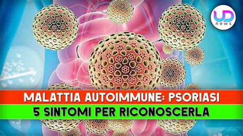 Malattia Autoimmune Psoriasi Sintomi Per Riconoscerla Youtube