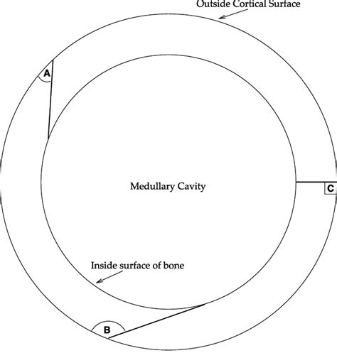 5. A figure looking longways down the medullary cavity of a longbone... | Download Scientific ...