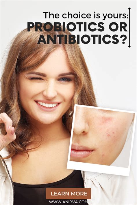 Antibiotics For Acne Artofit