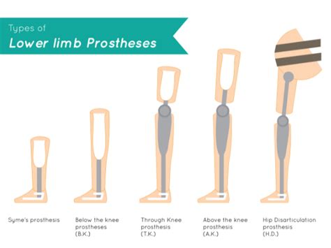 lower-limb-prosthesis-leg-amputation-rehabilitation-propel ...