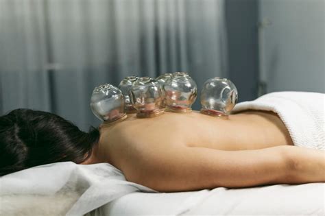 Acupuncture And Cupping For Chronic Pain Acupuncture Halls