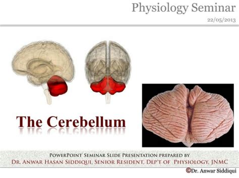 SOLUTION: The cerebellum - Studypool