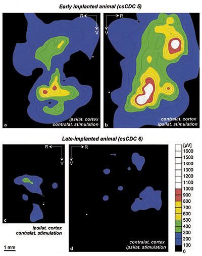 Cortical Activation Maps Obtained From Middle Latency Responses