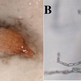 Morphology of Alternaria sp. (A) Colonies of Alternaria sp. on the seed ...