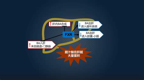 郑晓皎：18分钟详解菌群 胆汁酸与消化系统肿瘤