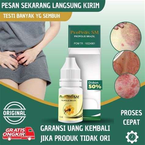 Jual Salep Gatal Selangkangan Salep Selangkangan Gatal Dan Lecet