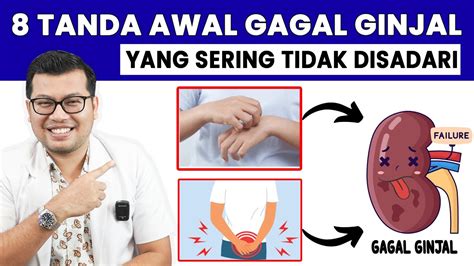 8 TANDA AWAL GAGAL GINJAL YANG SERING TIDAK DISADARI DOKTER SADDAM