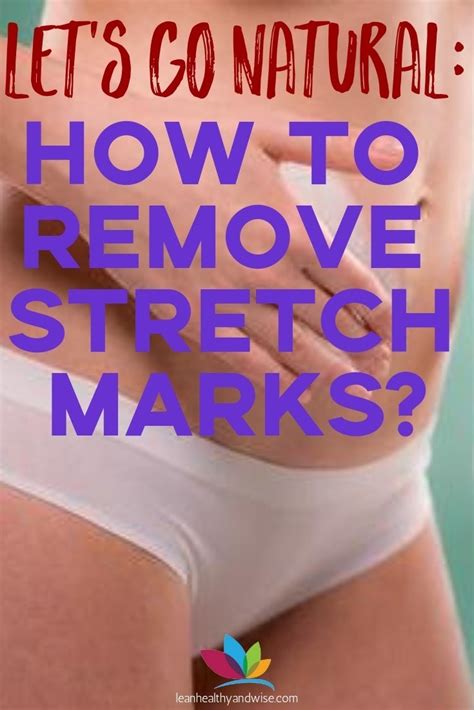 How To Remove Stretch Marks For Good