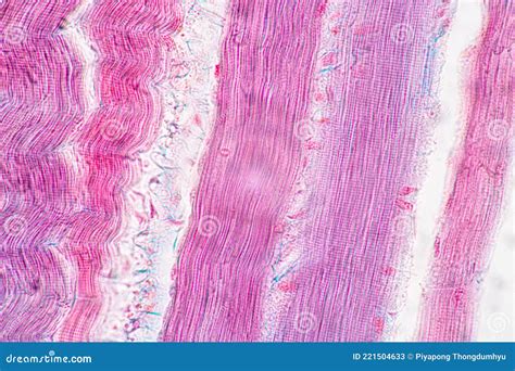 Skeletal Muscle Under Microscope Labeled