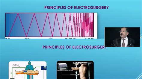 How To Use Monopolar Bipolar Harmonic Scalpel And Ligasure Part I