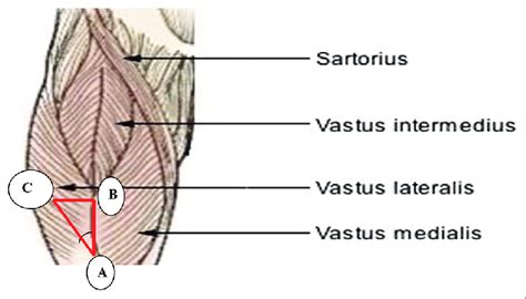 Vastus Lateralis Muscle Architectural Parameters Are Represented In