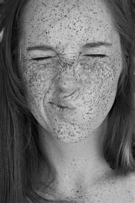 Pin en Freckles