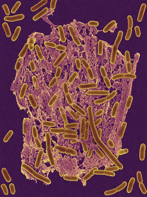 E Coli 0157h7 Photograph By Dennis Kunkel Microscopyscience Photo Library Pixels