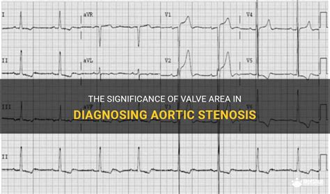 The Significance Of Valve Area In Diagnosing Aortic Stenosis Medshun