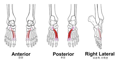 flexor hallucis brevis