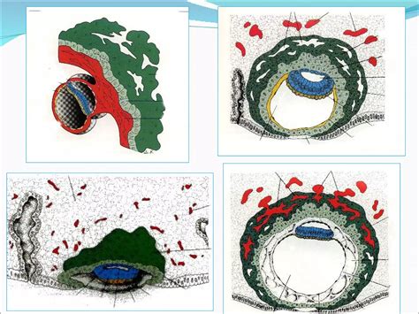 Membranas Fetales Placenta Ppt