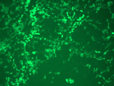 Slc A Nm Human Tagged Orf Clone Lentiviral Particle