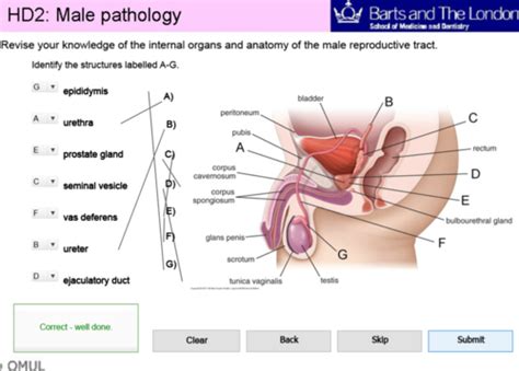 Male Repro Pathology Microanatomy Flashcards Quizlet