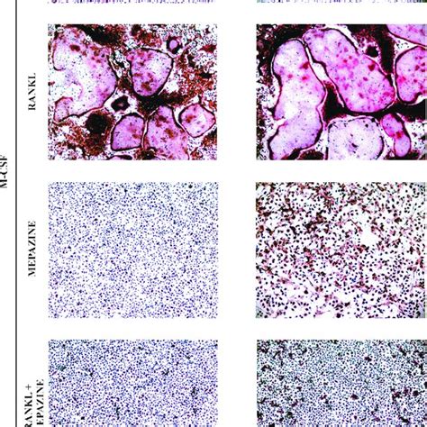 Mepazine Inhibits Rank Ligand Rankl Induced Osteoclastogenesis