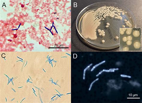 (A) Gram stain of the first positive aerobic blood culture showing ...