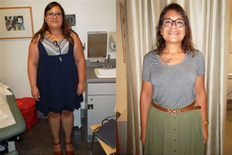 Sarahs Story Gastric Sleeve Ucla Health