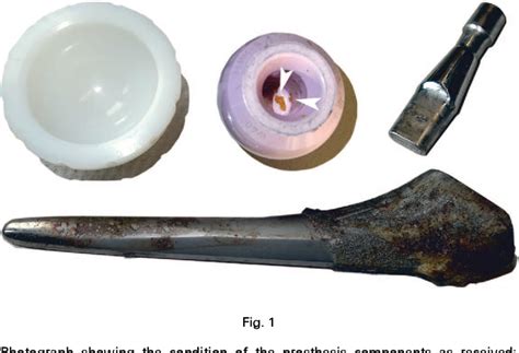 Figure From Quantification Of Material Loss From The Neck Piece Taper