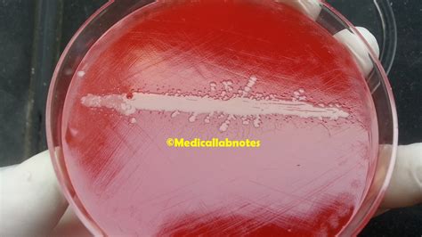 Haemophilus Serotyping Introduction Principle Test Requirements