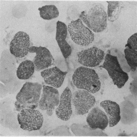 Complete Replacement Of Hematopoietic Elements Fig 3 Oat Cell Download Scientific Diagram