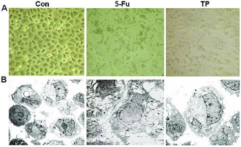 Effect Of Tp On Cell Morphology A Morphological Changes Of Mcf