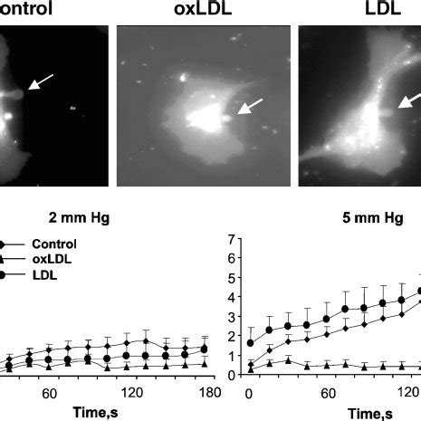 Oxidized Low Density Lipoprotein Oxldl But Not Ldl Constrains