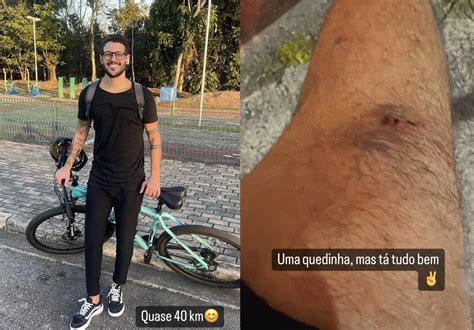 Rodrigo Mussi Comemora Primeiro Passeio De Bicicleta Ap S O Acidente