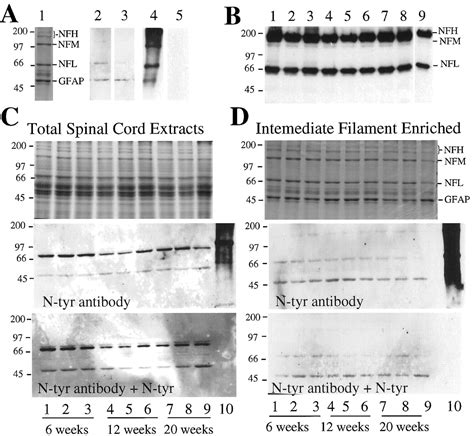 Elevated Free Nitrotyrosine Levels But Not Protein Bound Nitrotyrosine