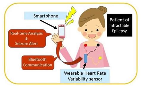 Heart Rate Variability Predicts Epileptic Seizures Neuroscience News