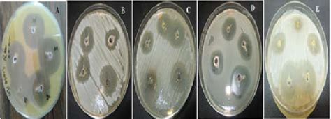 Inhibition Zones Of Agnps Against S Aureus Atcc 6538p A S Arlettae