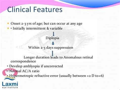 Accommodative esotropia