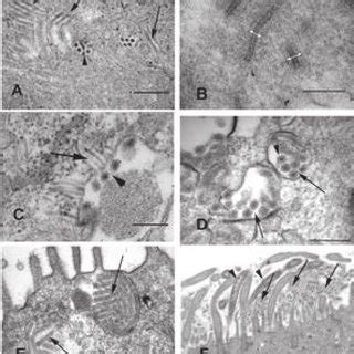 Transmission Electron Photomicrographs Of Pulmonary Epithelial Cells Of