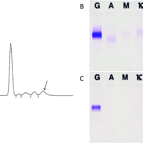 Serum electrophoresis and immunofixation of the serum and urine. A ...