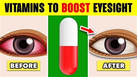 Top 7 Vitamins To Improve Your Eyesight Naturally Youtube