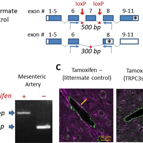 Generation Of The Smooth Muscle Specific Knock Out Mouse Model A