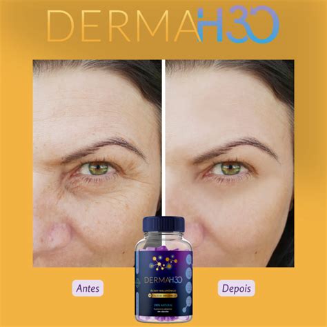 Derma H Funciona Mesmo Onde Comprar Pre O Site Oficial