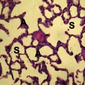 Lung Section In Rat Treated With Quercetin Showing Normal Architecture