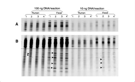 Denaturing Gradient Gel Electrophoresis Dgge Gel Profiles Of The V3 Download Scientific