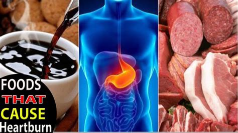 Heartburn 8 Foods That Cause Heartburn Health Solution Youtube