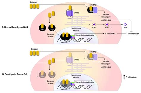 Ijms Free Full Text Gender Predilection In Sporadic Parathyroid