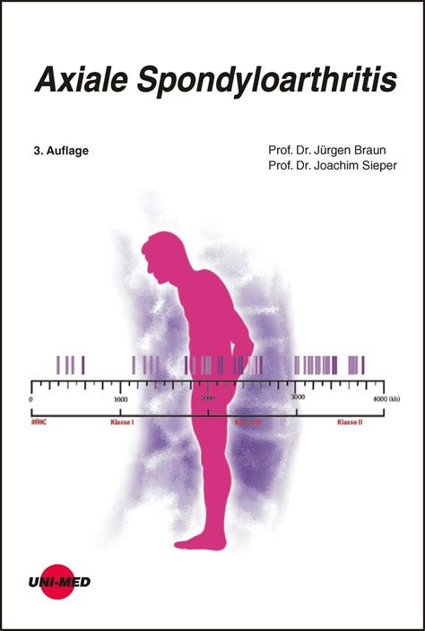 Axiale Spondyloarthritis E Book Frohberg