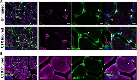 Frontiers Single Cell Analysis Reveals Satellite Cell Heterogeneity