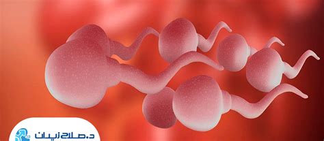 اسباب وجود دم في السائل المنوي دكتور صلاح زيدان